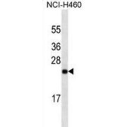 Ubiquitin Carboxyl Terminal Hydrolase L1 (UCHL1) Antibody