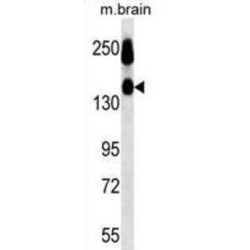 Neural Cell Adhesion Molecule 1 / CD56 (NCAM1) Antibody