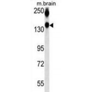 Neural Cell Adhesion Molecule 1 / CD56 (NCAM1) Antibody