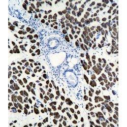 Actin, Alpha Skeletal Muscle (ACTA1) Antibody