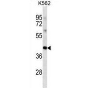 POU Class 5 Homeobox 1 / OCT4 (POU5F1) Antibody