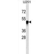 Sorting Nexin 6 (SNX6) Antibody