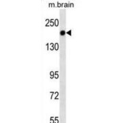 Hamartin (TSC1) Antibody