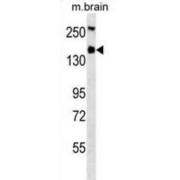 abx025351