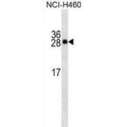 Serum Amyloid P-Component (APCS) Antibody