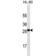 Tumor Necrosis Factor Ligand Superfamily Member 4 / OX40L (TNFSF4) Antibody