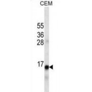 Western blot analysis of extract of CEM cell line lysate (35 µg/lane) using INS antibody.