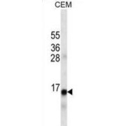 Western blot analysis of extract of CEM cell line lysate (35 µg/lane) using INS antibody.