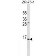 Insulin (INS) Antibody