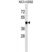 abx025366