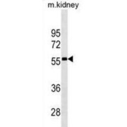 abx025367
