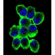 abx025377