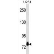 abx025381