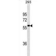 Nuclear Receptor Coactivator 4 (NCOA4) Antibody