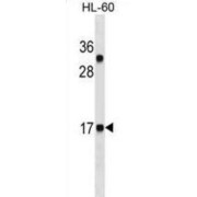 Calcitonin (CALCA) Antibody