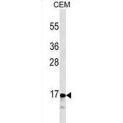 Calcitonin (CALCA) Antibody