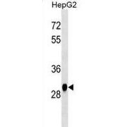 Histamine N-Methyltransferase (HNMT) Antibody