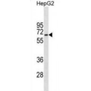 Serine/Threonine Kinase 39 (STK39) Antibody