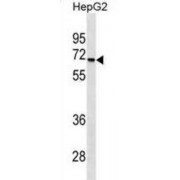 Serine/Threonine Kinase 39 (STK39) Antibody