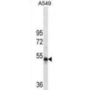 RuvB-Like 1/Pontin 52 (RUVBL1) Antibody
