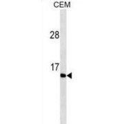 WB analysis of CEM cell line lysates (35 µg/lane), using Gastrin (GAST) Antibody. GAST detection is demonstrated by the arrow.