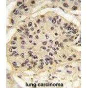 Transcription Factor SOX-2 (SOX2) Antibody