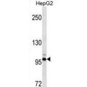 Discoidin Domain Receptor Tyrosine Kinase 2 (DDR2) Antibody