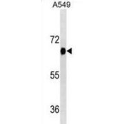 abx025430