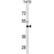 Cytochrome P450 3A4 (CYP3A4) Antibody