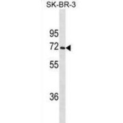 abx025440