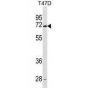 abx025443