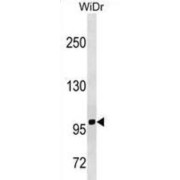 Transferrin Receptor Protein 1 / CD71 (TFRC) Antibody