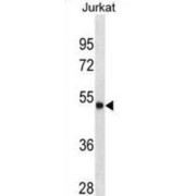 Arylsulfatase A (ARSA) Antibody