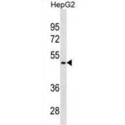 Protein AMBP (AMBP) Antibody