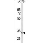 Melanocyte-Stimulating Hormone Receptor (MC1R) Antibody