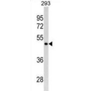 GATA Binding Protein 4 (GATA4) Antibody