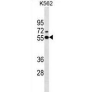 abx025483