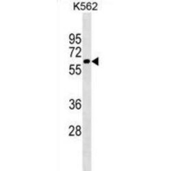 Catalase (CAT) Antibody