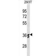 abx025489
