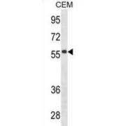 Immunoglobulin Heavy Constant Delta (IGHD) Antibody