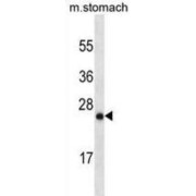 Ly6/PLAUR Domain-Containing Protein 6B (LYPD6B) Antibody