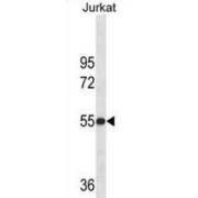 Protein-Lysine 6-Oxidase (LOX) Antibody