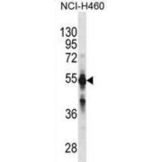 abx025527