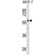 Glycocalicin (GC) Antibody