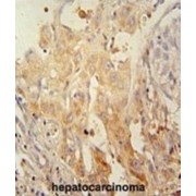 Serine/Threonine-Protein Kinase PINK1, Mitochondrial (PINK1) Antibody