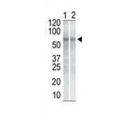 Serine/threonine-Protein Kinase Chk1 (CHK1) Antibody