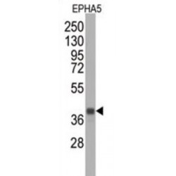 Ephrin Type A Receptor 5 (EPHA5) Antibody
