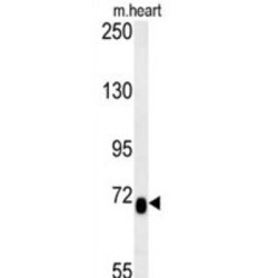 Lebercilin-Like Protein (LCA5L) Antibody