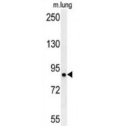 Leucine-Rich Repeat-Containing Protein 4B (LRRC4B) Antibody