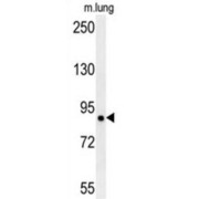 Leucine-Rich Repeat-Containing Protein 4B (LRRC4B) Antibody